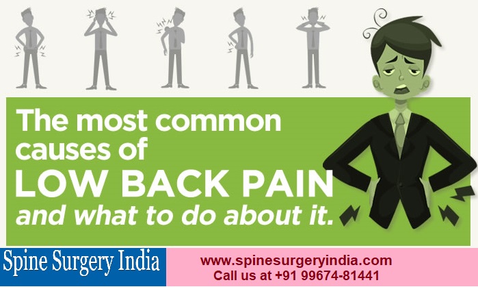 What Are The Common Causes Of Back Pain