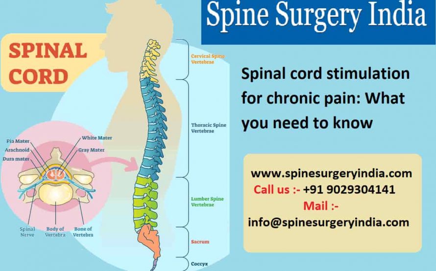 Spinal cord stimulation for chronic pain